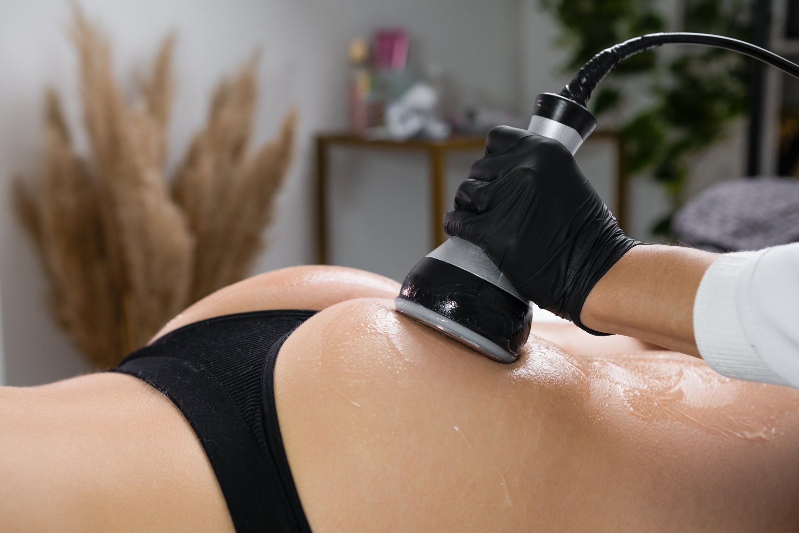 CAVITACIÓN 1 ZONA SUELTA